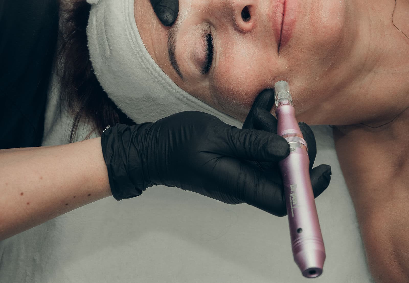 Tratamientos faciales profesionales